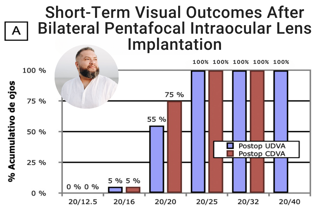 Dr. Kepa Balparda shares his clinical results with the Intensity IOL.